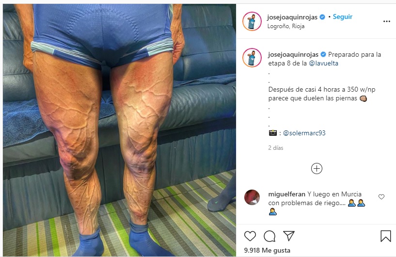 Impactante: un ciclista muestra sus piernas con las venas 'a punto de estallar' durante la Vuelta a España 1 2 - ig - 1
