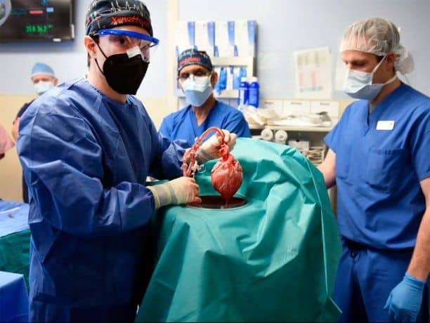 EE.UU: el hombre al que le trasplantaron el corazón de un cerdo tiene antecedentes penales 1 2 - trasplante corazon cerdo - 1