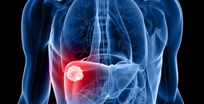 El viernes se realizarán testeos voluntarios de hepatitis en la Plaza 9 de Julio