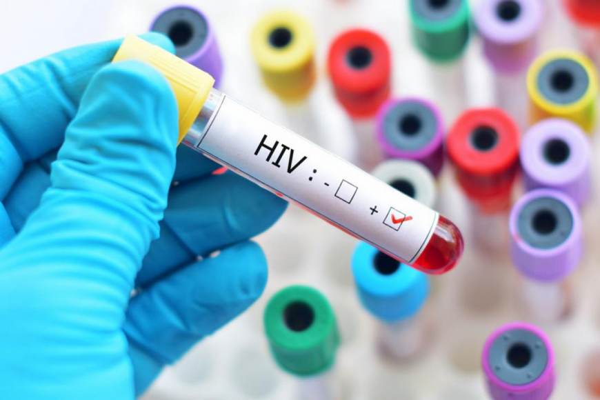 La triple frontera se une en contra del HIV