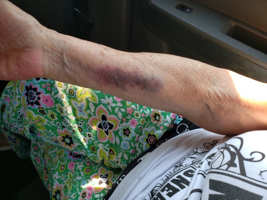 Detuvieron a una mujer acusada de golpear a su mamá de 80 años