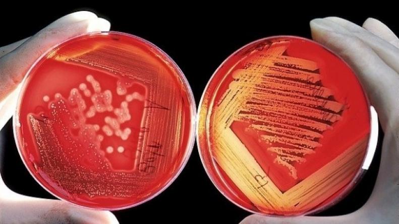Streptococcus pyogenes: qué es, cómo se transmite y cuáles son los síntomas