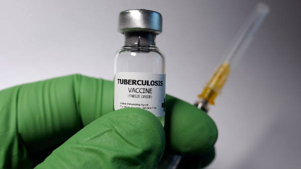 ¿Qué cambios tiene la nueva vacuna que podría controlar la tuberculosis?