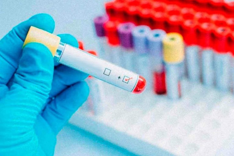Francia: habrían hallado una vacuna para eliminar el virus del VIH
