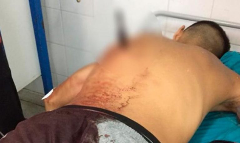 Una mujer apuñaló a un motochorro en Córdoba