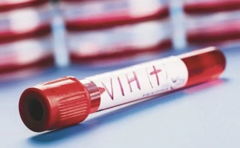 VIH: segundo caso de remisión aumenta expectativa por cura del sida
