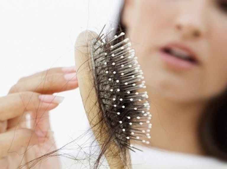 La caída del cabello puede ser síntoma de alguna enfermedad