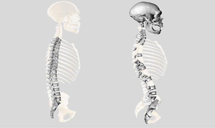 El uso del celular modificó el esqueleto humano