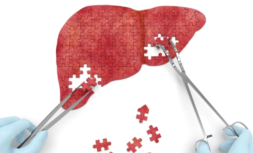 Estiman que más de un millón de argentinos viven con hepatitis B y C: el 80% no presenta síntomas