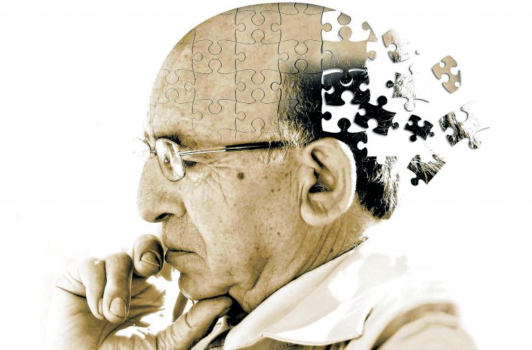 Mediante una investigación, lograrán evitar la formación de las células generadoras del Alzheimer