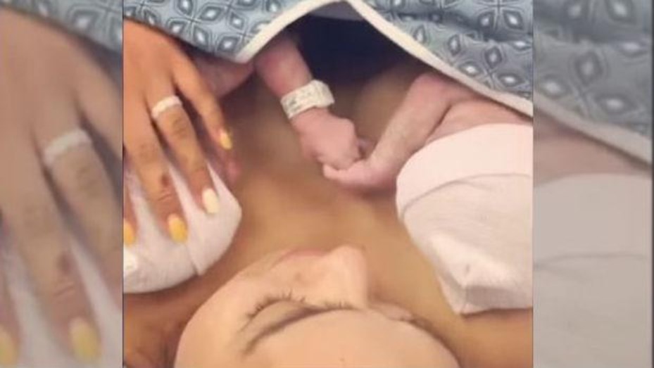 Viral: las gemelas que nacieron agarradas de la mano