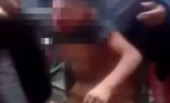 Salta: un nene gastó 20 pesos en golosinas y su mamá le fracturó el cráneo con un machete