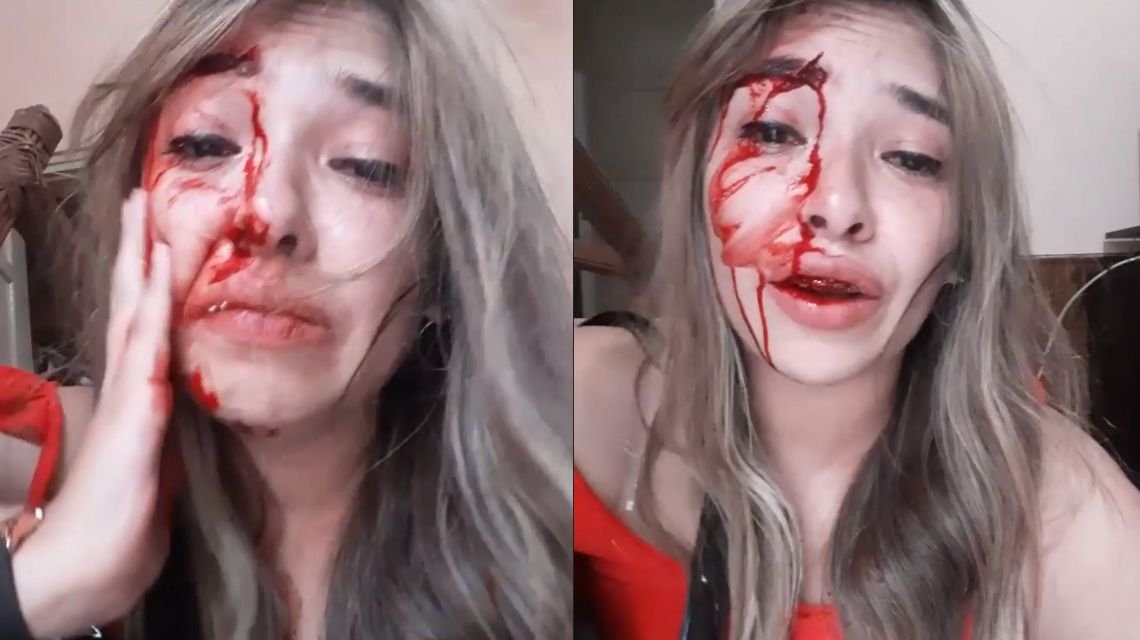Santa Fe: lo dejó y su novio le dio una brutal paliza