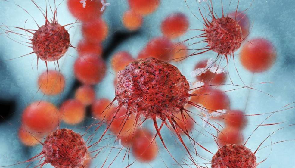 Cáncer: científicos descubren causa de metástasis y se analiza posible tratamiento