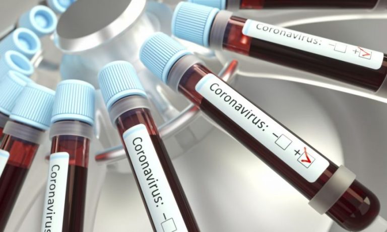 Coronavirus: Salud Pública confirmó que bajó a 100 el número de personas en aislamiento voluntario