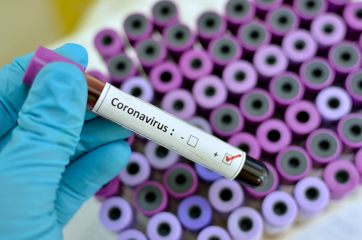 Salud Pública confirmó el quinto caso de coronavirus en Misiones