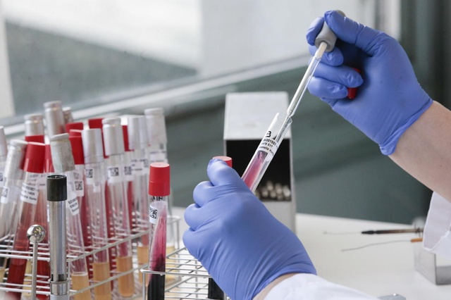 Coronavirus en Misiones: 13 externados y 691 casos descartados