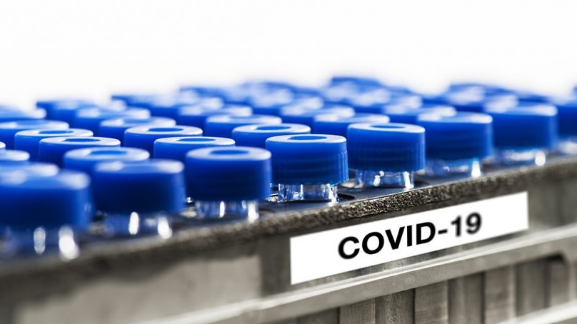 Covid-19: hace una semana que no se detectan nuevos casos en Misiones