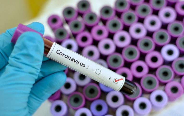 Ascienden a 353 los fallecidos y a 7134 los contagiados de coronavirus en el país