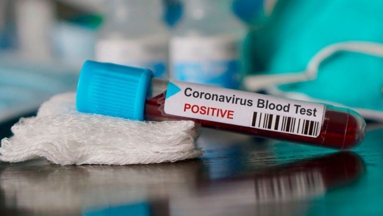 #Coronavirus en Misiones: dos jóvenes posadeñas, las nuevas contagiadas