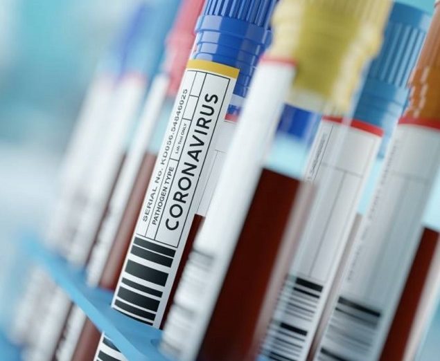 #Coronavirus: por noveno día consecutivo, Misiones no sumó casos positivos