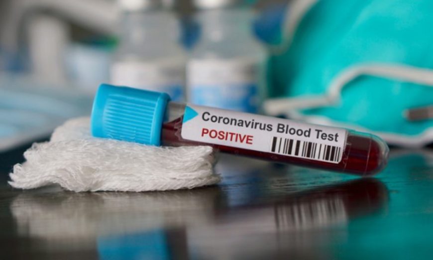 #Coronavirus en Argentina: reportaron 29 nuevas muertes y ascienden a 2617 las víctimas fatales