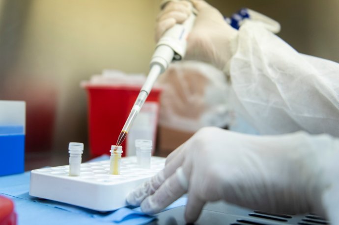 #Coronavirus en Argentina: reportaron 20 nuevas muertes y el total de víctimas fatales asciende a 2.913