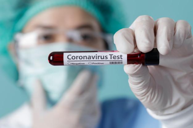 #Coronavirus: hubo 44 muertes en las últimas 24 horas y son más de 67 mil contagiados en Argentina