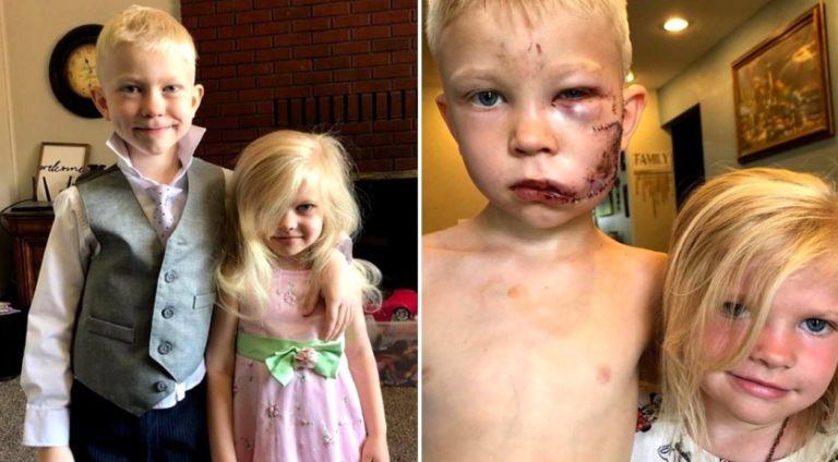 El héroe que conmueve al mundo: un nene de seis años salvó a su hermana del ataque de un perro