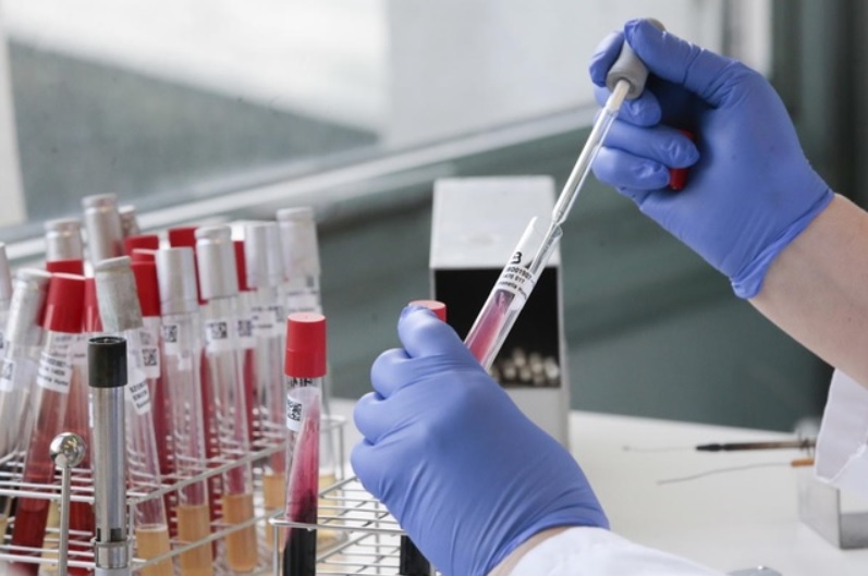 Coronavirus en el país: hubo 137 muertes y 5352 nuevos casos en las últimas 24 horas