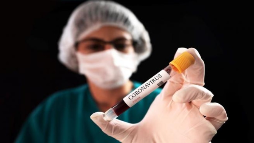 #Coronavirus en Argentina: se registraron 48 nuevas muertes y el total de fallecidos asciende a 8401