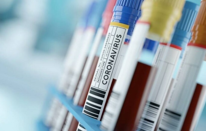 #Coronavirus: Misiones no confirmó nuevos casos positivos