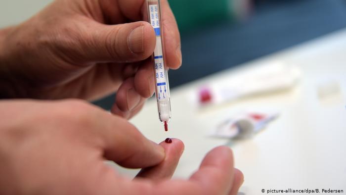 El Gobierno nacional ordenó la compra de reactivos para VIH