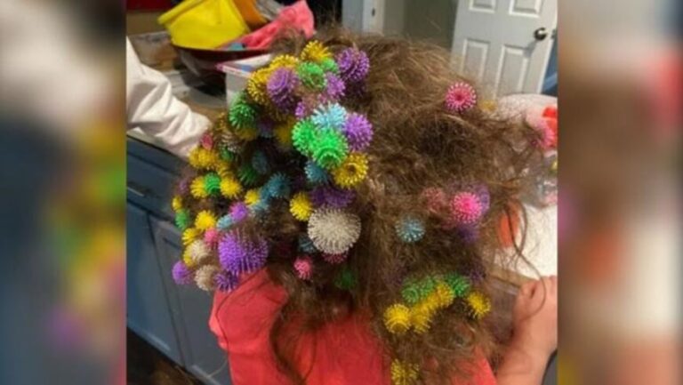 Odisea de una madre: tuvo que desenredar el cabello de su hija que se le habían pegado 150 juguetes