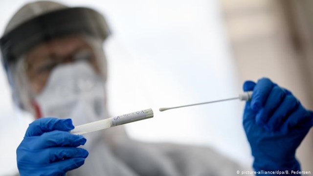 Llegaron los hisopados anales a España y se utilizarán en pacientes graves