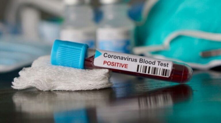 Coronavirus en Argentina: confirmaron 122 muertes y 5.944 nuevos contagios
