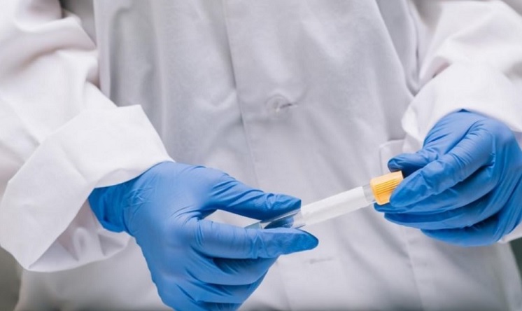 Reportaron dos nuevos muertos y 129 casos positivos de Covid-19 en Misiones