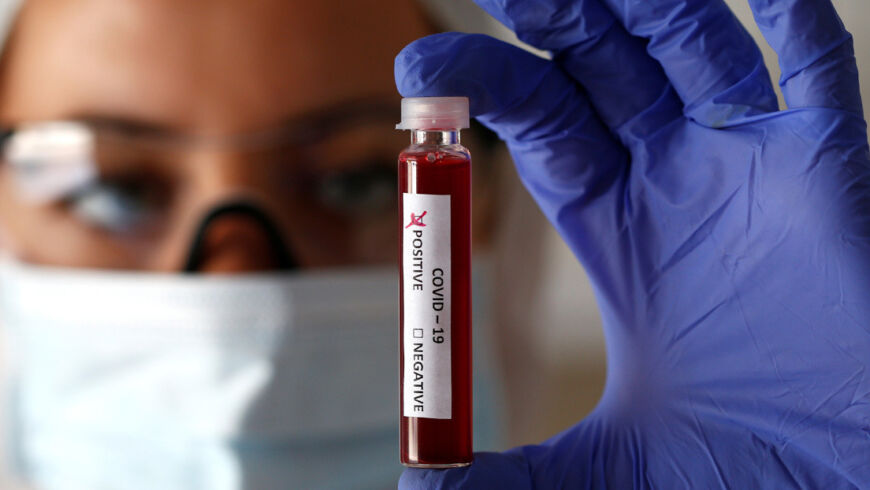 Coronavirus en Argentina: informaron 7307 nuevos casos y 131 muertes en 24 horas