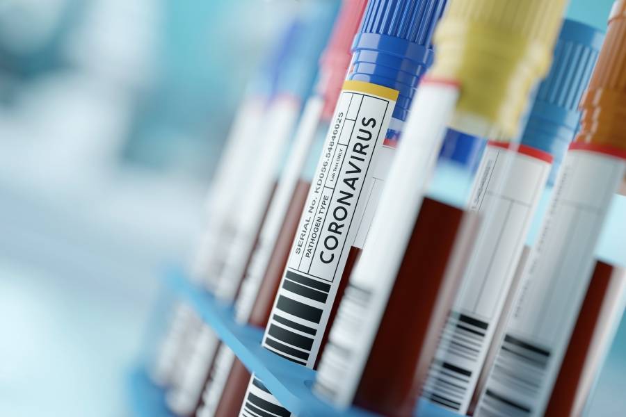 Otras 166 personas murieron y 6.164 fueron diagnosticadas con coronavirus en el país
