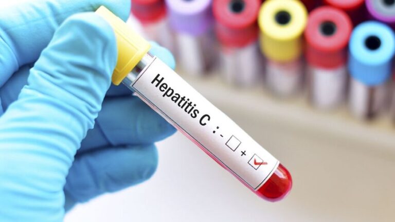 La hepatitis C ya no es impedimento para donar órganos o recibir un trasplante