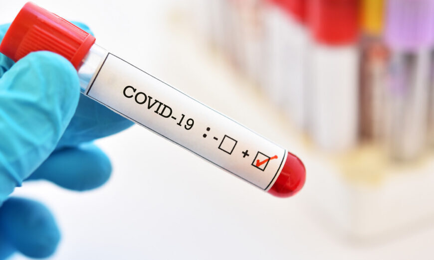 Argentina sumó 24.801 nuevos casos y 375 muertos por coronavirus en las últimas 24 horas