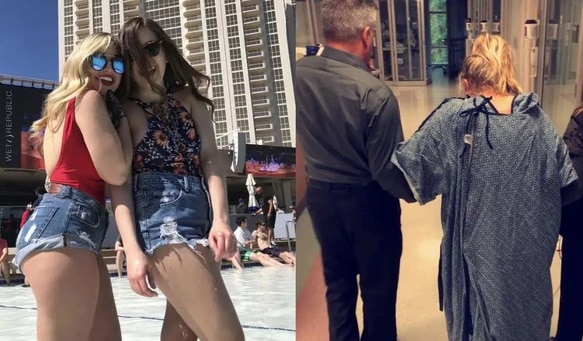 Una joven terminó en terapia intensiva por haber usado shorts ajustados