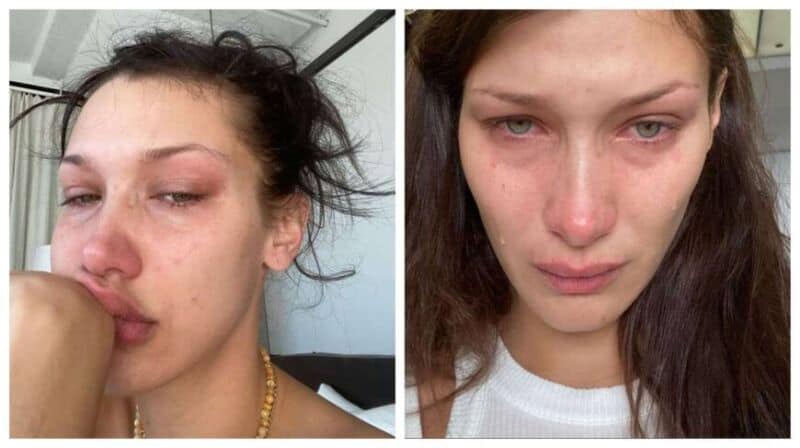 “Las redes sociales no son reales”: Bella Hadid habló de la depresión que generan y de su salud mental