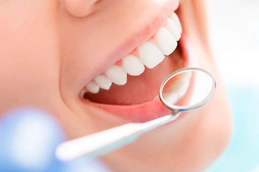 Cómo prevenir la erosión ácida en los dientes