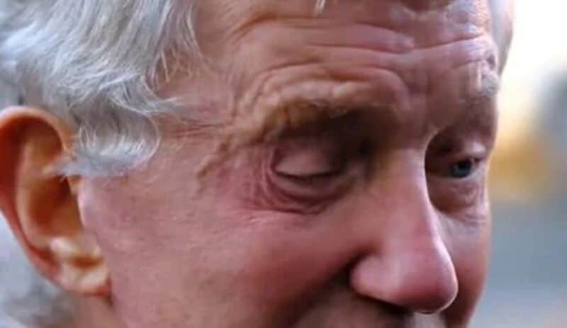 La desafortunada historia del hombre lleva tres años sin poder cerrar los ojos por una cirugía estética