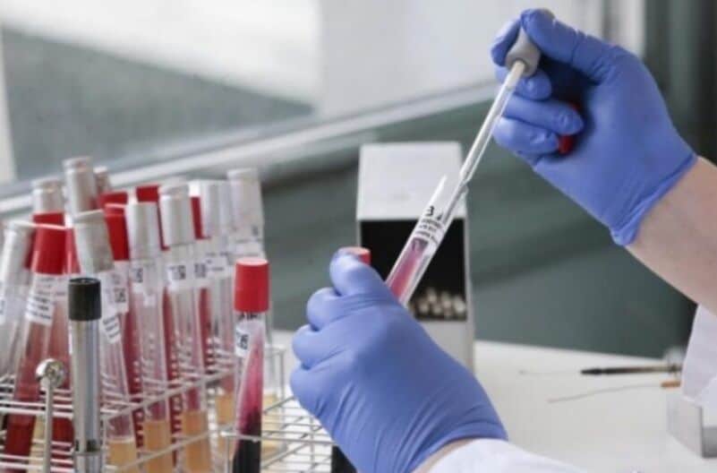 Misiones contabilizó 109 casos positivos de Covid-19 y por tercer día consecutivo no se reportaron muertos