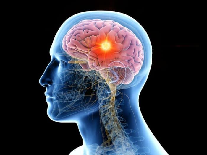 Meningitis: síntomas y prevención de la enfermedad