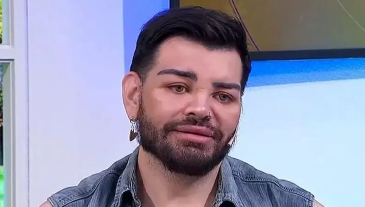Participó de Cuestión de Peso y se hizo más de 30 cirugías: “Quedé más lindo que Ricky Martin”