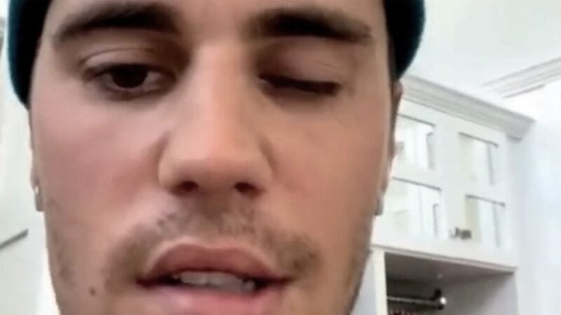 Justin Bieber suspendió varios shows de su gira por sufrir una parálisis facial