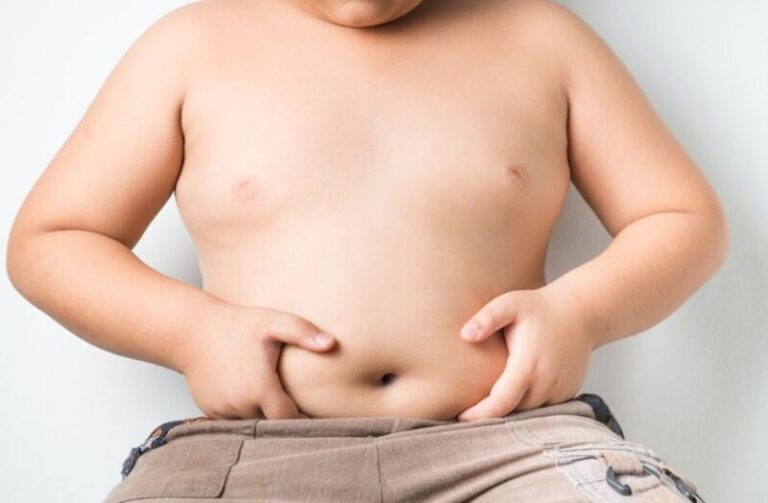 Obesidad infantil: Argentina tiene el índice más alto en Sudamérica